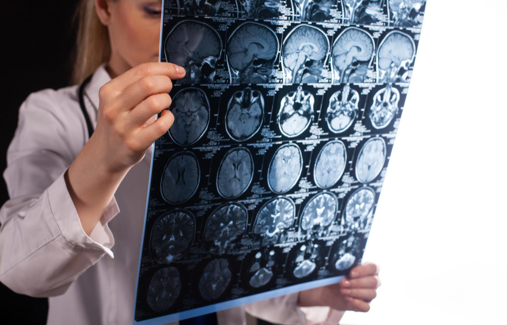 Traumatic Brain Injuries