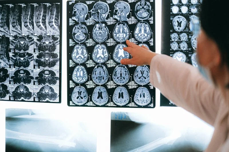 Radiologist examining brain MRI scans representing traumatic brain injury diagnosis