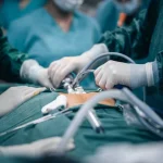 Surgeons performing an operation representing surgical error and medical malpractice claims